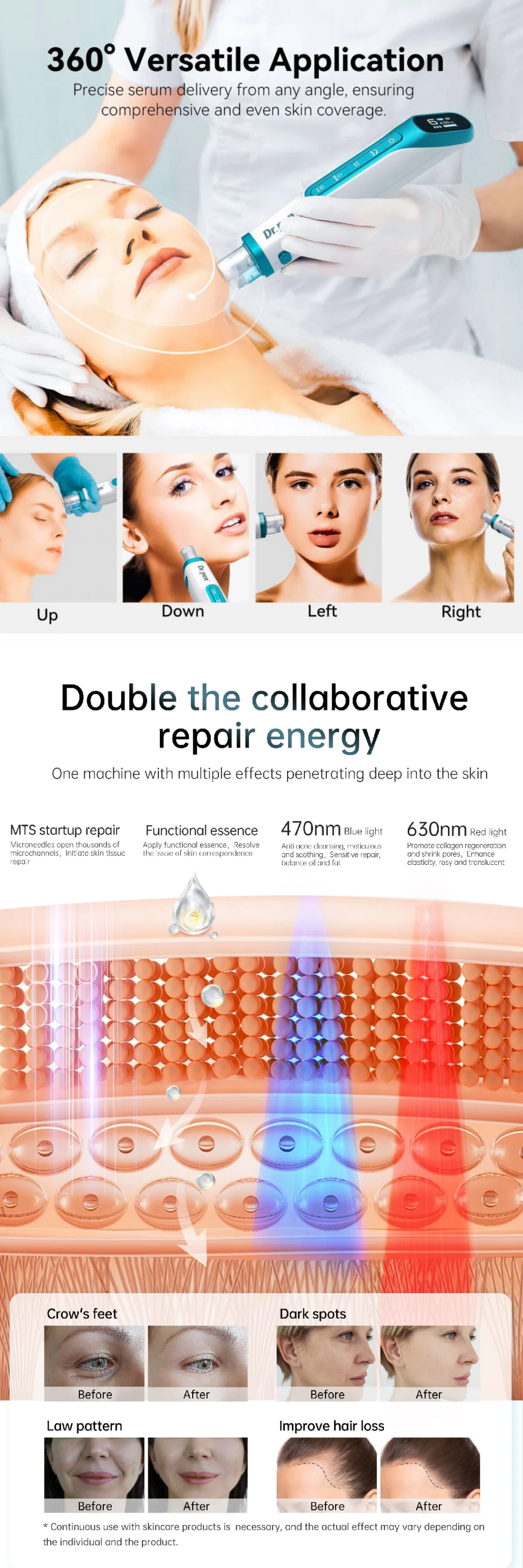 Dr. Pen H6 Microneedling Pen with LED Light and Serum Infusion