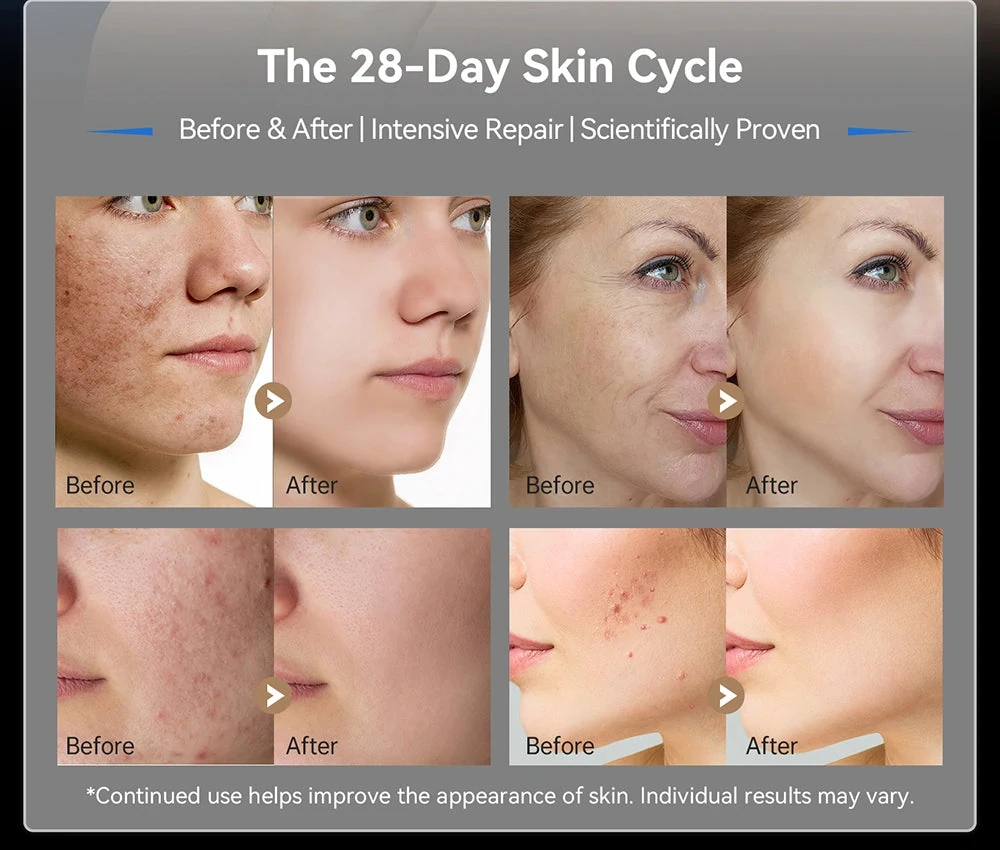Before and after skin improvement results showing the 28-Day Skin Cycle program.